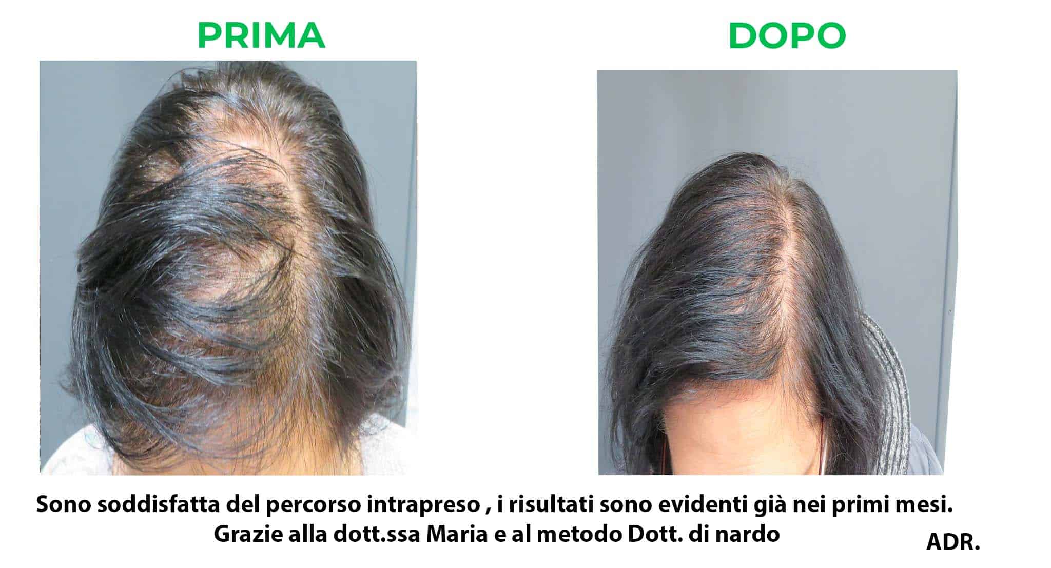 prima_dopo_adr