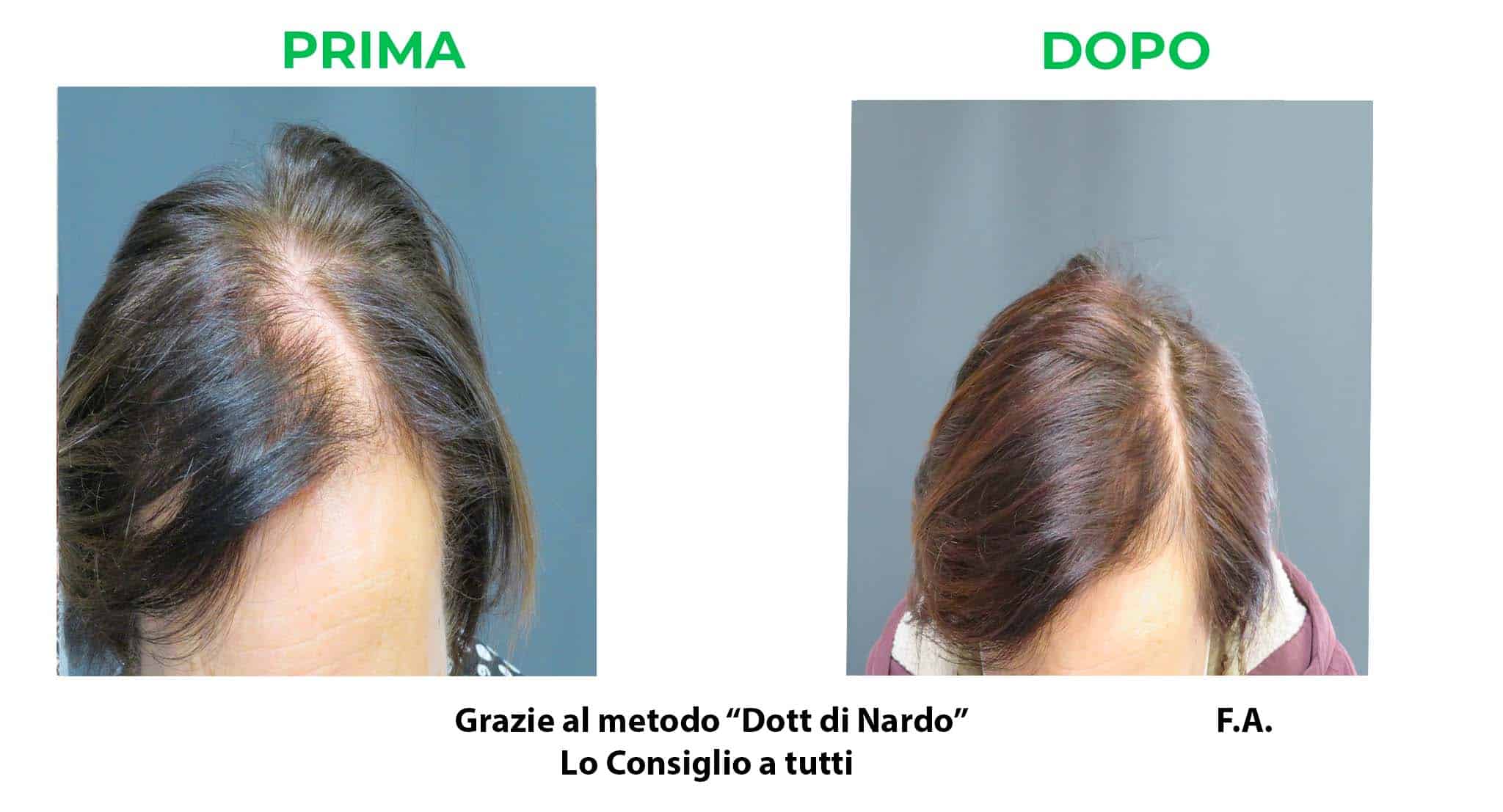 prima_dopo_fa